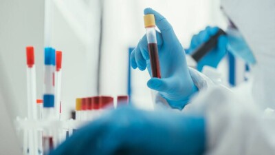 Учёные ЮАР: "Омикрон" в три раза повышает риск повторно заразиться Covid-19