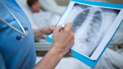 В Казахстане за сутки зарегистрировали 478 случаев заражения Covid-19, два пациента скончались