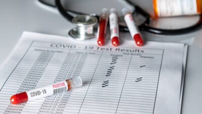 В Казахстане за сутки зарегистрировали 1477 случаев заражения Covid-19