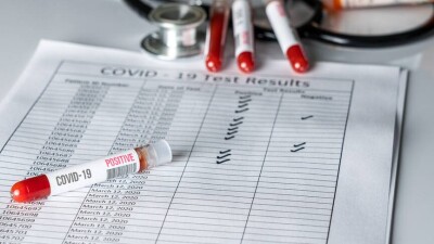 В России сократили срок действия ПЦР-тестов. Это важно учитывать казахстанцам при въезде в страну