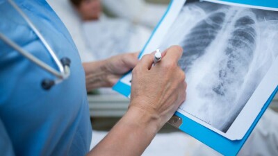 Цой: 2,3% летальных случаев в Казахстане приходится на привитых, которые имели хронические заболевания