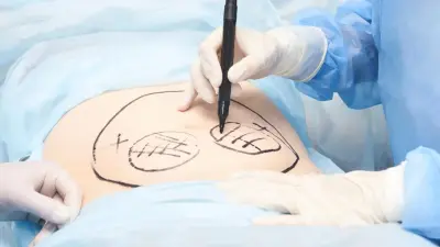 "Предстоит ещё не одна операция". Жительница Костаная попала в реанимацию после липосакции