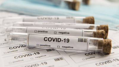 В Казахстане за сутки выявили 717 случаев заражения Covid-19
