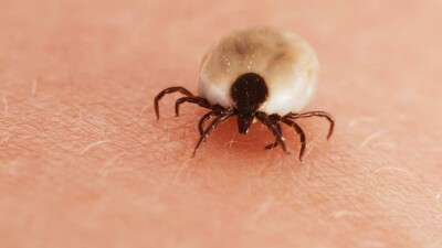 В Туркестанской области заявили о смерти подростка от укуса клеща