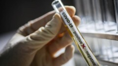 В Казахстане за сутки зарегистрировали 28 случаев заражения Covid-19