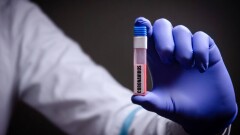 В Казахстане за сутки зарегистрировали 85 случаев заражения коронавируcом