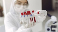 Коронавирус в КНДР: за сутки выявили 393 тысячи заболевших