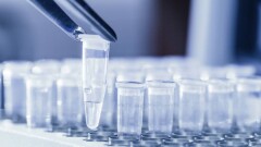 В Казахстане за сутки зарегистрировали 2579 случаев заражения Covid-19