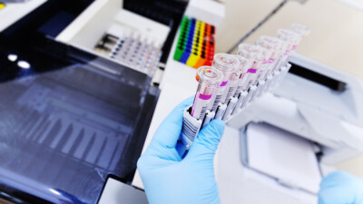 В Казахстане за сутки зарегистрировали 2641 случай заражения Covid-19,  650 – в Нур-Султане