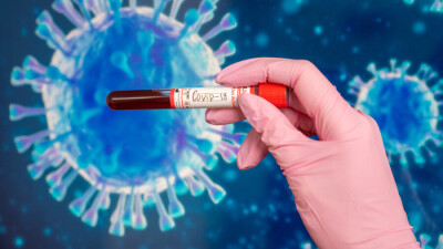 В Казахстане за сутки зарегистрировали 2883 случая заражения Covid-19