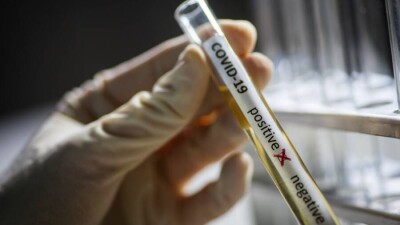 В Казахстане за сутки зарегистрировали 28 случаев заражения Covid-19