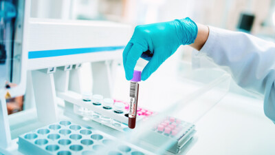 В Казахстане за сутки зарегистрировали 2298 случаев заражения Covid-19