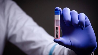 В Казахстане за сутки зарегистрировали 69 случаев заражения коронавирусом