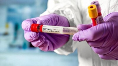 369 случаев заражения Covid-19 зарегистрировали за сутки в Казахстане