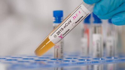 В Казахстане за сутки зарегистрировали 151 случай заражения Covid-19