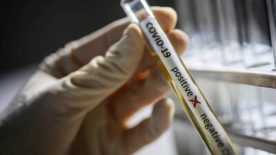 В Казахстане за сутки зарегистрировали 2661 случай заражения Covid-19