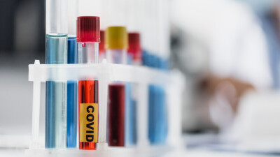 В Казахстане за сутки зарегистрировали 1663 случая заражения Covid-19