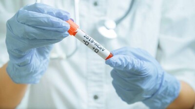 В Казахстане за сутки зарегистрировали 1248 случаев заражения Covid-19, в Нур-Султане – больше 400