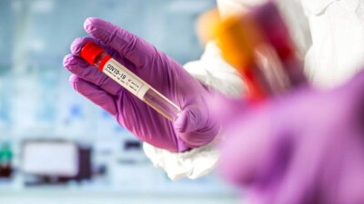 В Казахстане за сутки зарегистрировали 59 случаев заражения Covid-19