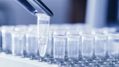 В Казахстане за сутки зарегистрировали 68 случаев заражения Covid-19