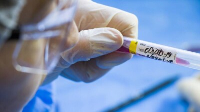 В Казахстане за сутки зарегистрировали 967 случаев заражения Covid-19