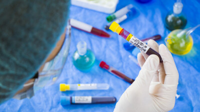 В Казахстане за сутки зарегистрировали 2267 случаев заражения Covid-19