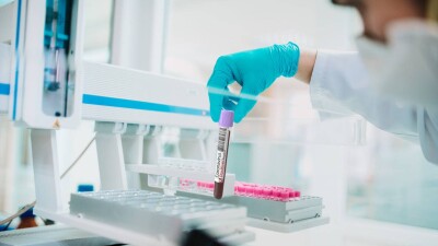 В Казахстане за сутки зарегистрировали 61 случай заражения коронавирусом