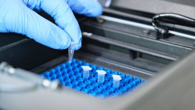 В Казахстане за сутки зарегистрировали 7778 случаев заражения Covid-19, больше всего их в Алматы