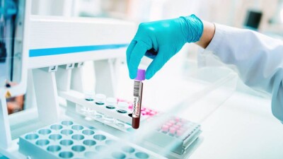 В Казахстане за сутки зарегистрировали 7479 случаев заражения Covid-19