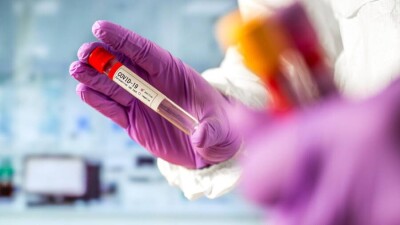 В Казахстане за сутки зарегистрировали 930 случаев заражения Сovid-19