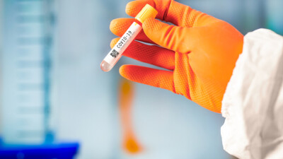 В Казахстане за сутки зарегистрировали 571 случай заражения Covid-19