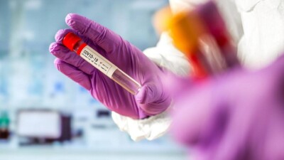 В Казахстане за сутки зарегистрировали 34 случая заражения коронавирусом