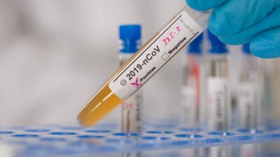 В Казахстане за сутки зарегистрировали 2792 случая заражения Covid-19