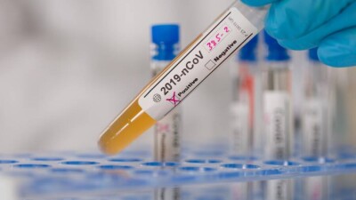 В Казахстане за сутки зарегистрировали 18 случаев заражения Сovid-19