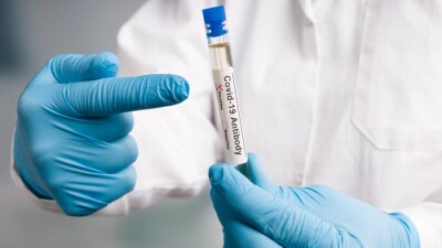 В Казахстане за сутки зарегистрировали 16 случаев заражения Covid-19