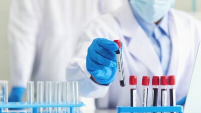 В Казахстане за сутки зарегистрировали 334 случая заражения Сovid-19