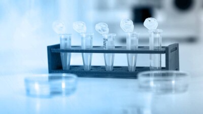 В Казахстане за сутки зарегистрировали 3899 случаев заражения Covid-19