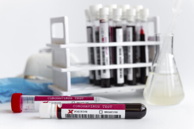 В Казахстане за сутки зарегистрировали 1105 случаев заражения Covid-19