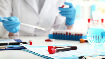 В Казахстане за сутки зарегистрировали 2443 случая заражения Covid-19