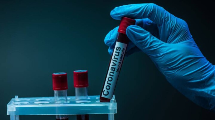 В Казахстане за сутки зарегистрировали 1123 случая заражения Covid-19