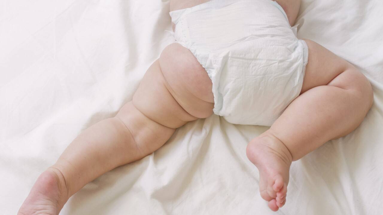 Жөргек дерматиті: "Памперсті" жиі қолданатын аналарға кеңестер