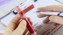 Екпе алған студент жеке стартабын іске қосуға 5 миллион теңге алады. Жеңілдік ұсынатын ЖОО тізімі тағы онға көбейді