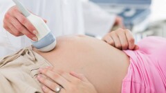 Қазақстанда демография мәселелерімен неге Денсаулық сақтау министрлігі айналыспайды