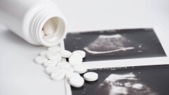 Франция әйелдердің түсік жасау құқығын Конституциямен қорғамақ