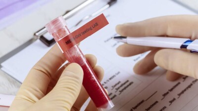 Екпе алған студент жеке стартабын іске қосуға 5 миллион теңге алады. Жеңілдік ұсынатын ЖОО тізімі тағы онға көбейді