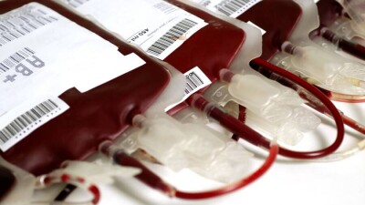 Қарағанды облысында қан донорлары жетіспей жатыр. Әсіресе теріс топтағы қан тапшы