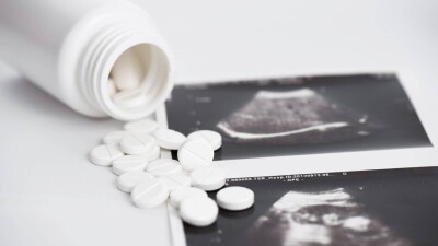 Франция әйелдердің түсік жасау құқығын Конституциямен қорғамақ