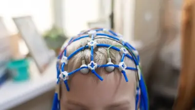 Әлемде 3 миллиардтан астам адам жүйке жүйесінің ауруларына шалдыққан