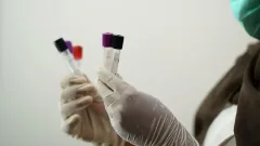 Не встречавшуюся ранее группу крови случайно выявили у женщины из Индии