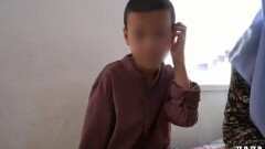 В Мангистау оштрафуют родителей ребёнка, которому ампутировали руку после лечения у знахаря